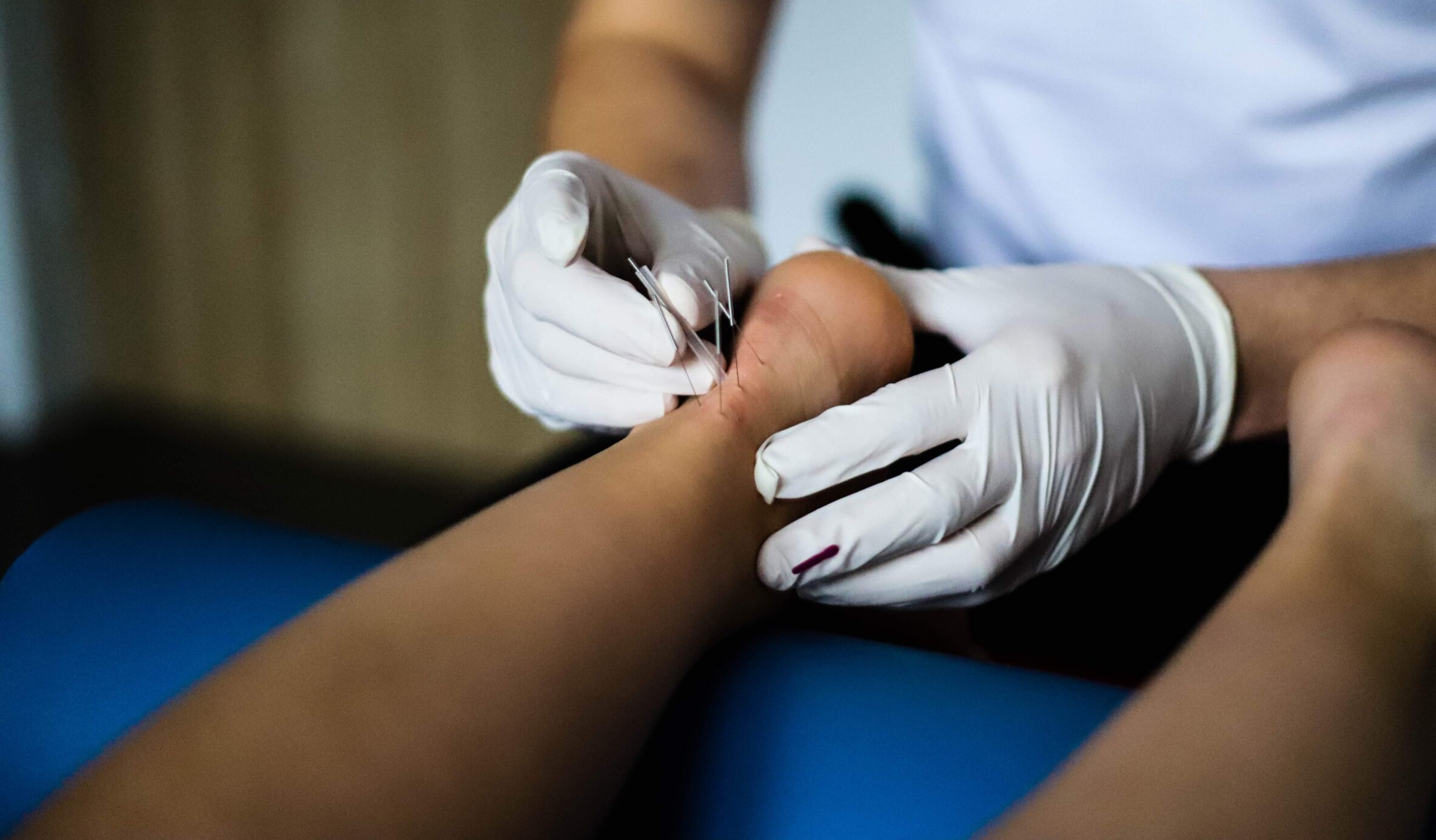 Suche igłowanie w dysfunkcjach mięśniowo-powięziowych