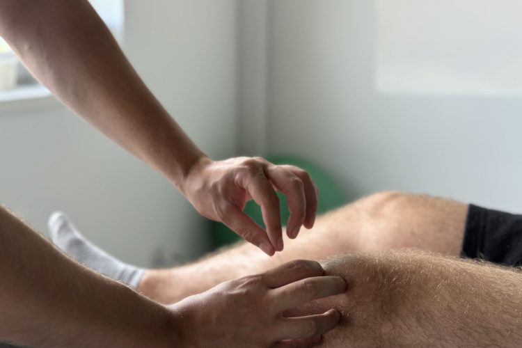 Suche igłowanie w dysfunkcjach mięśniowo-powięziowych