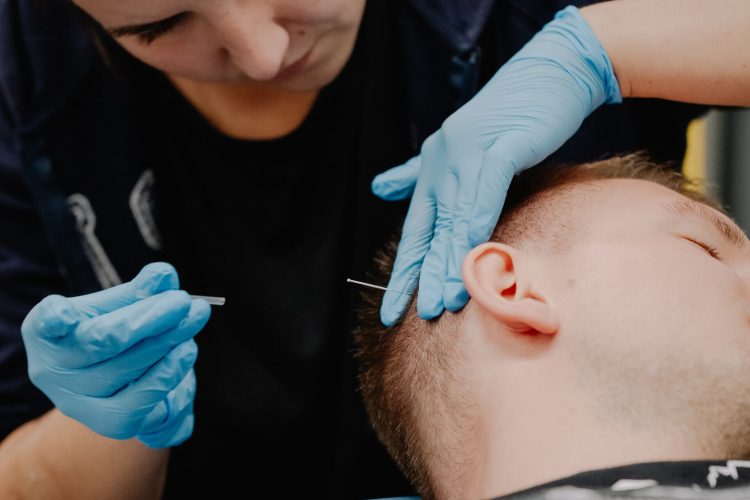 Suche igłowanie w dysfunkcjach mięśniowo-powięziowych