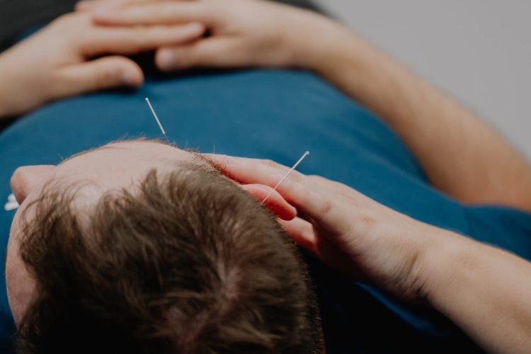 Suche igłowanie w dysfunkcjach mięśniowo-powięziowych